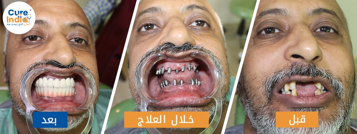 أبو موسى من المملكة السعودية